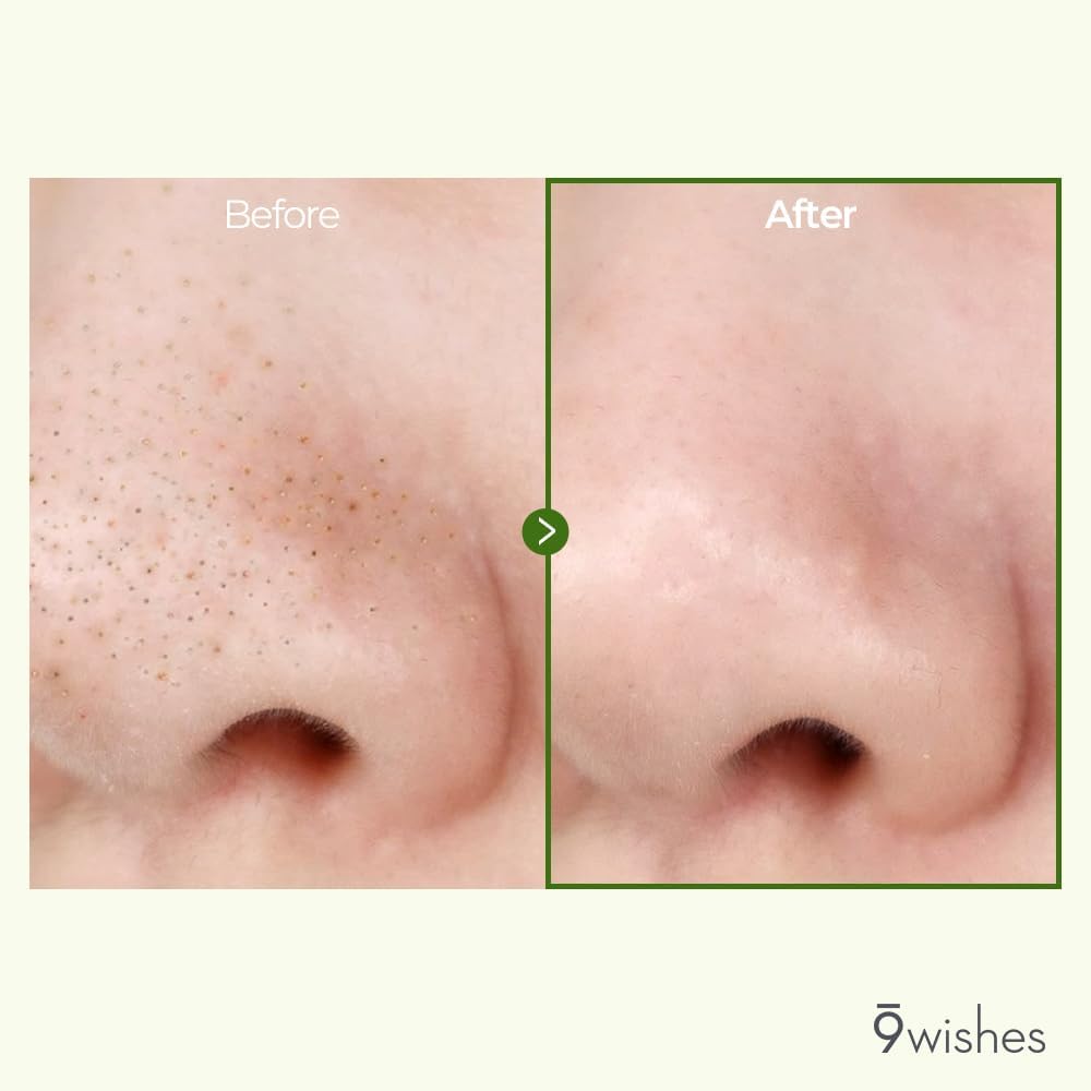 9Wishes Amazing Pore Serum with Pine Needle Spicules - 25ml - Image 4
