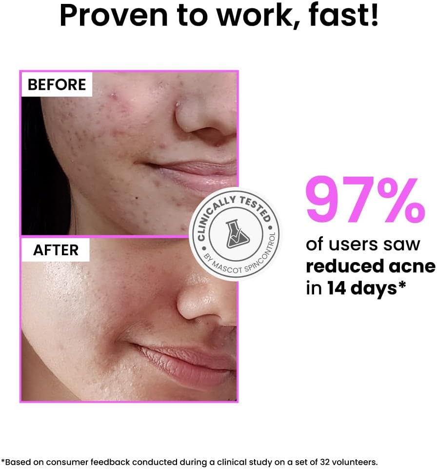 Foxtale Niacinamide Clarifying Serum - 12% with Azelaic Acid, 30ml - Image 4