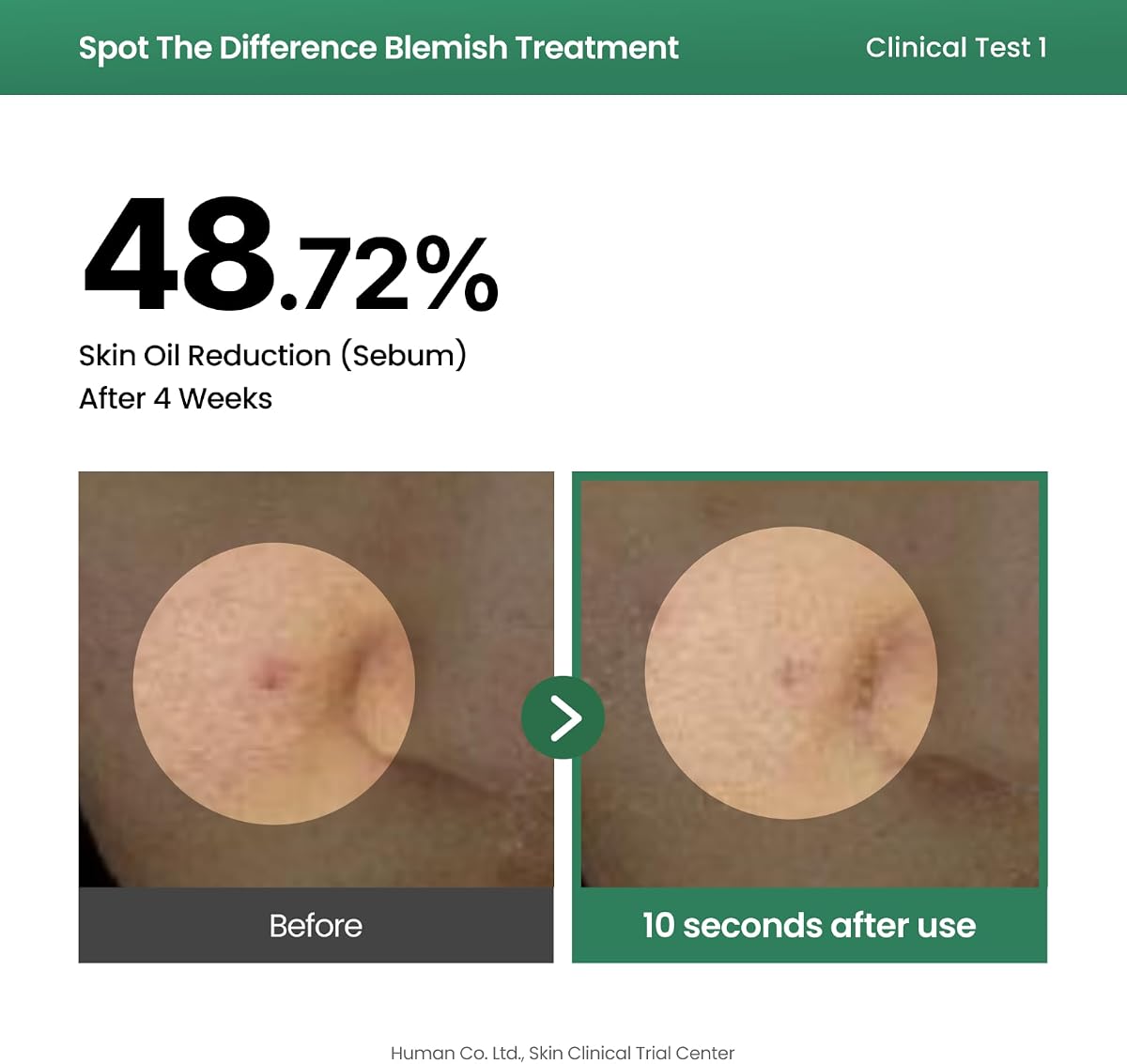 AXIS-Y Spot the Difference Blemish Treatment Serum 15ml - 4-Terpineol & Niacinamide - Image 5