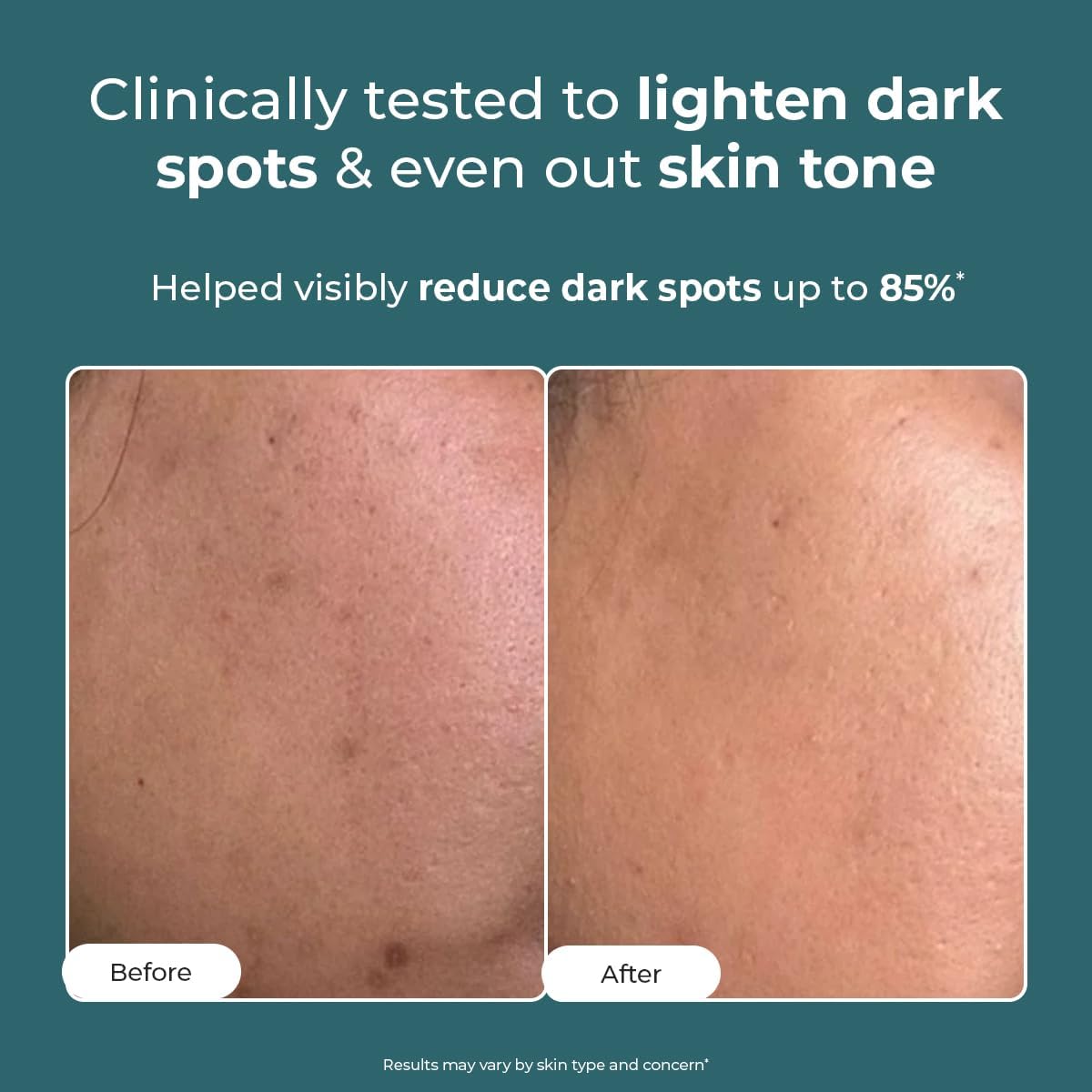 Conscious Chemist Face Moisturiser with Kojic Acid - 50g - Image 2