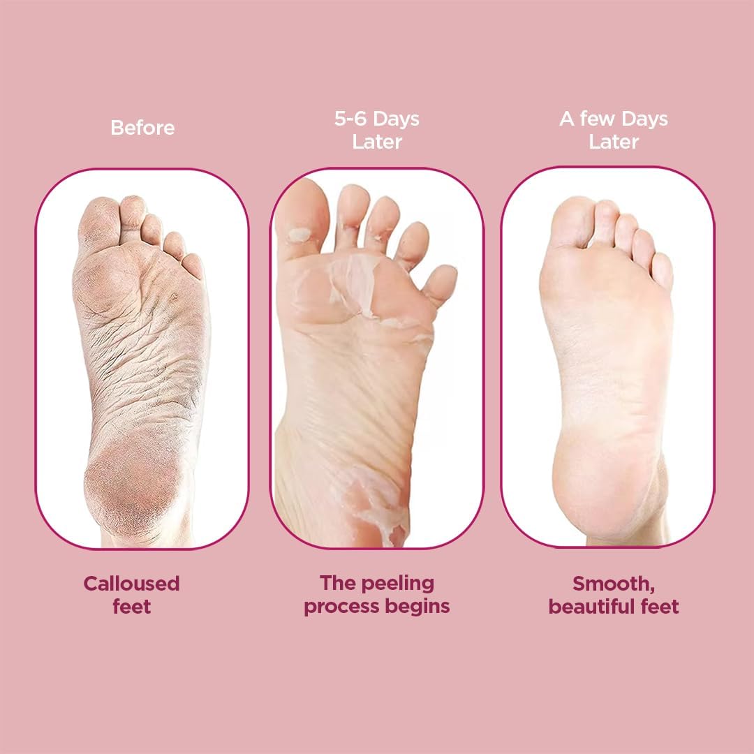 Pee Safe Furr Exfloating Foot Peel Mask - Foot Exfoliator Mask - Image 5