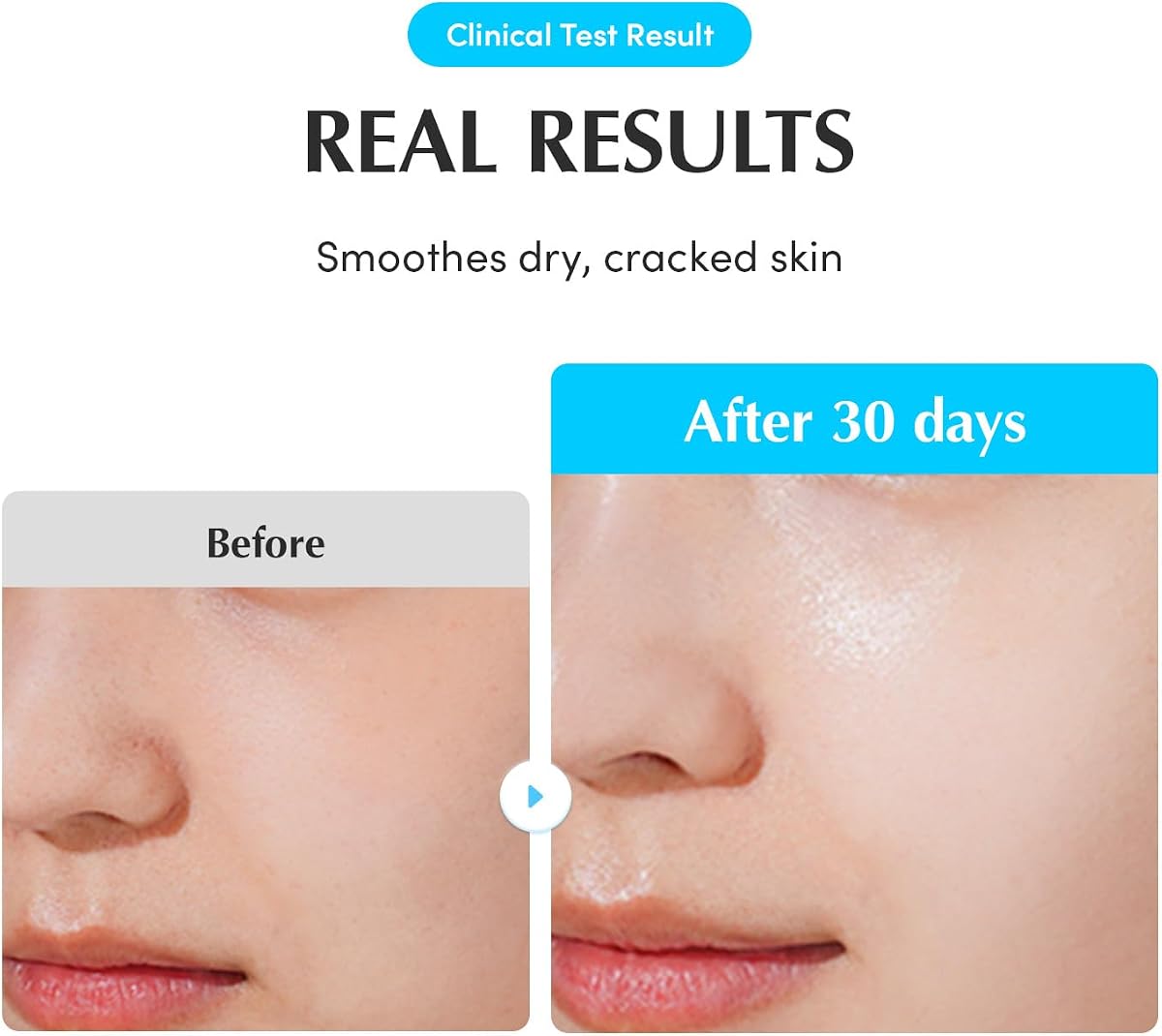 Eqqualberry Hydrating Hyaluronic Acid Face Serum with Cica Extracts - 50ml - Image 6