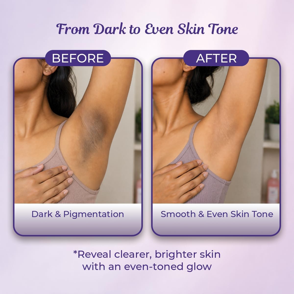 Sanfe Intimate Lightening Serum with Kojic Acid & Vitamin C - 50g - Image 2