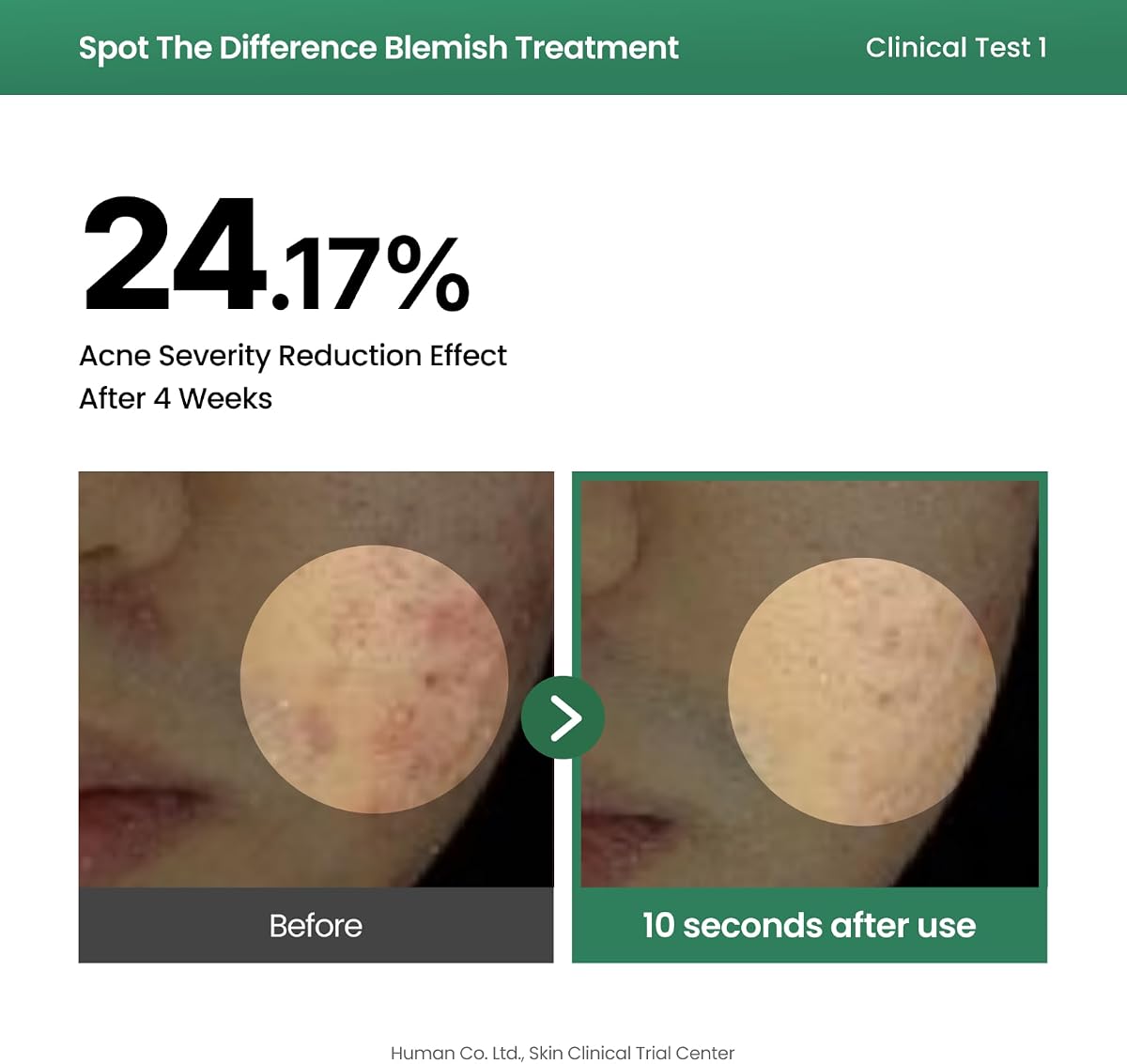 AXIS-Y Spot the Difference Blemish Treatment Serum 15ml - 4-Terpineol & Niacinamide - Image 6