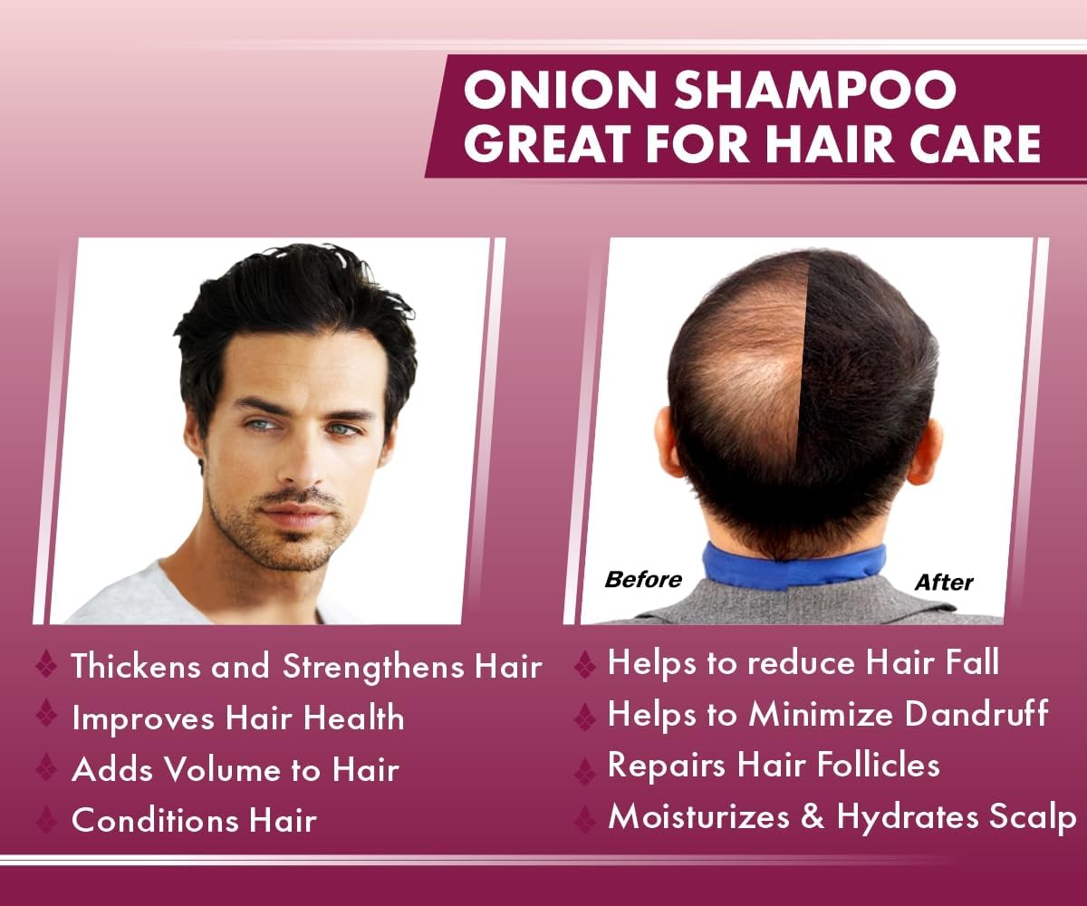Urban Gabru Natural Onion Shampoo - Paraben & Sulphate Free, 200g - Image 6