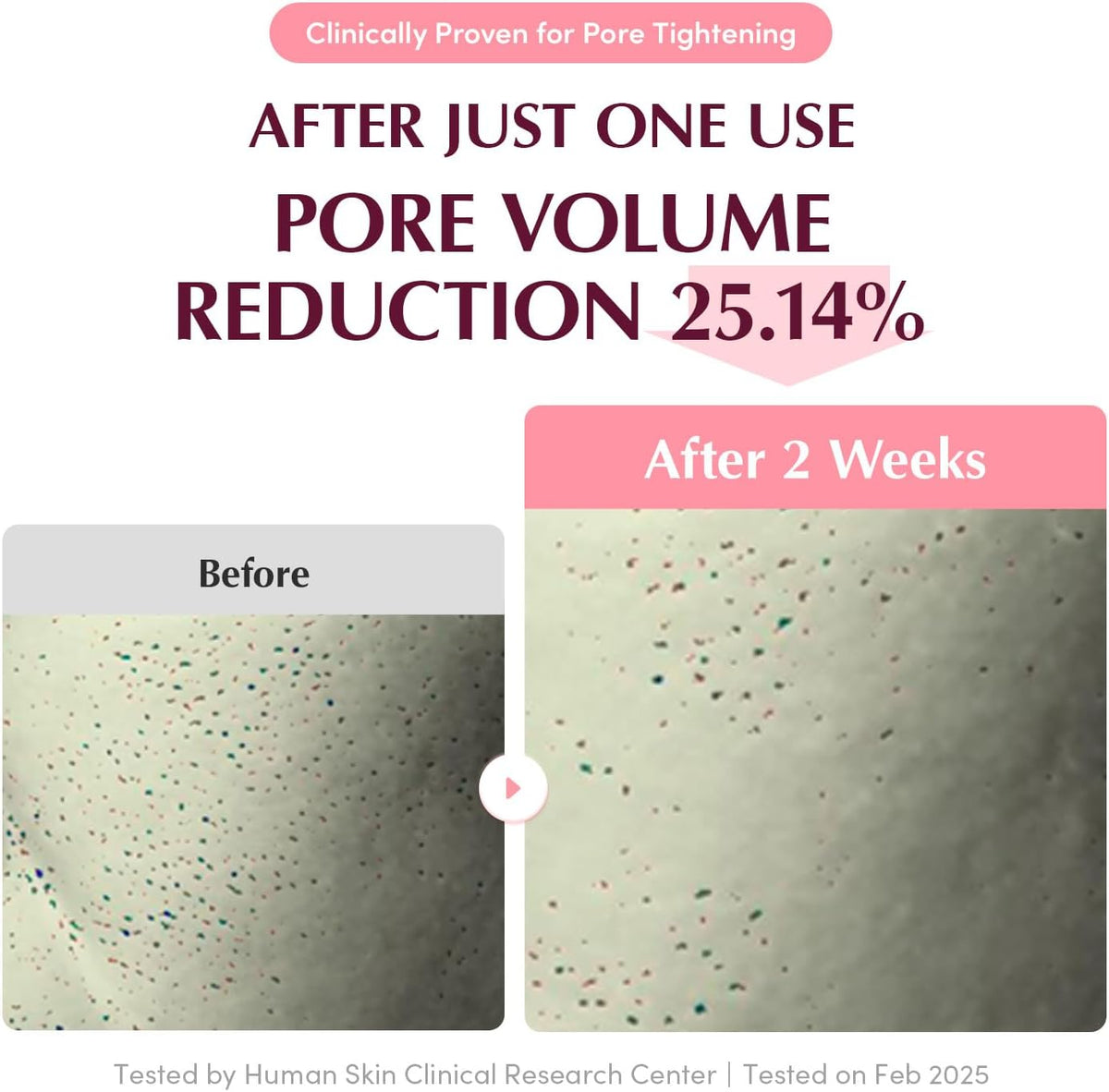 Eqqualberry Collagen Pore-Tight Up Hydrogel Mask - 4 Sheets, 30g Each - Image 5
