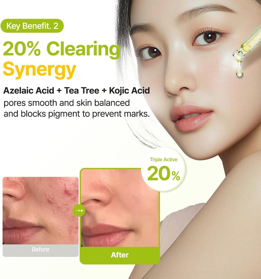 Purito Seoul Azelaic Acid 10% + Kojic + Tea Tree Serum - 30ml - Image 6