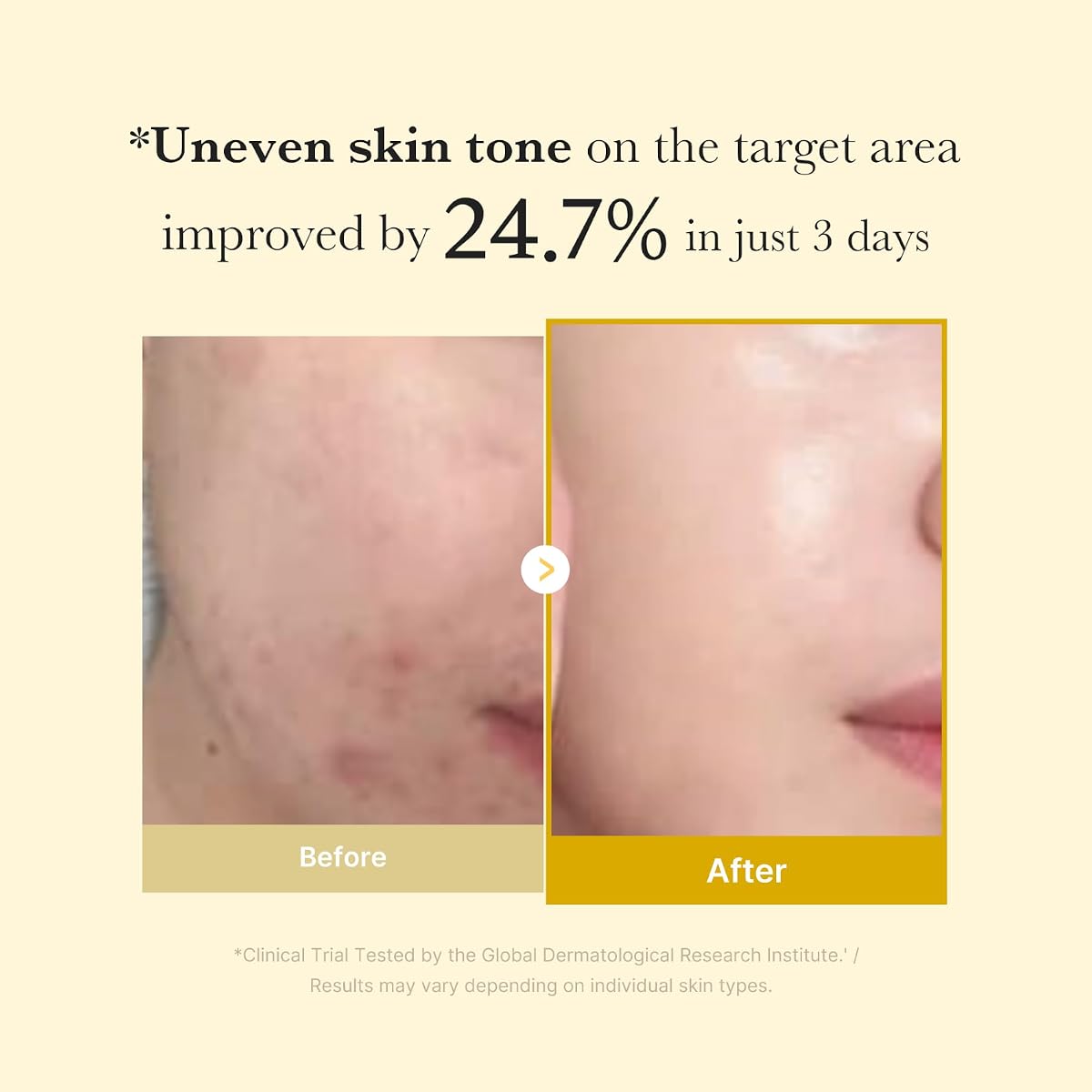 Medicube Night Wrapping Mask with Kojic Acid & Turmeric - 75Ml - Image 4