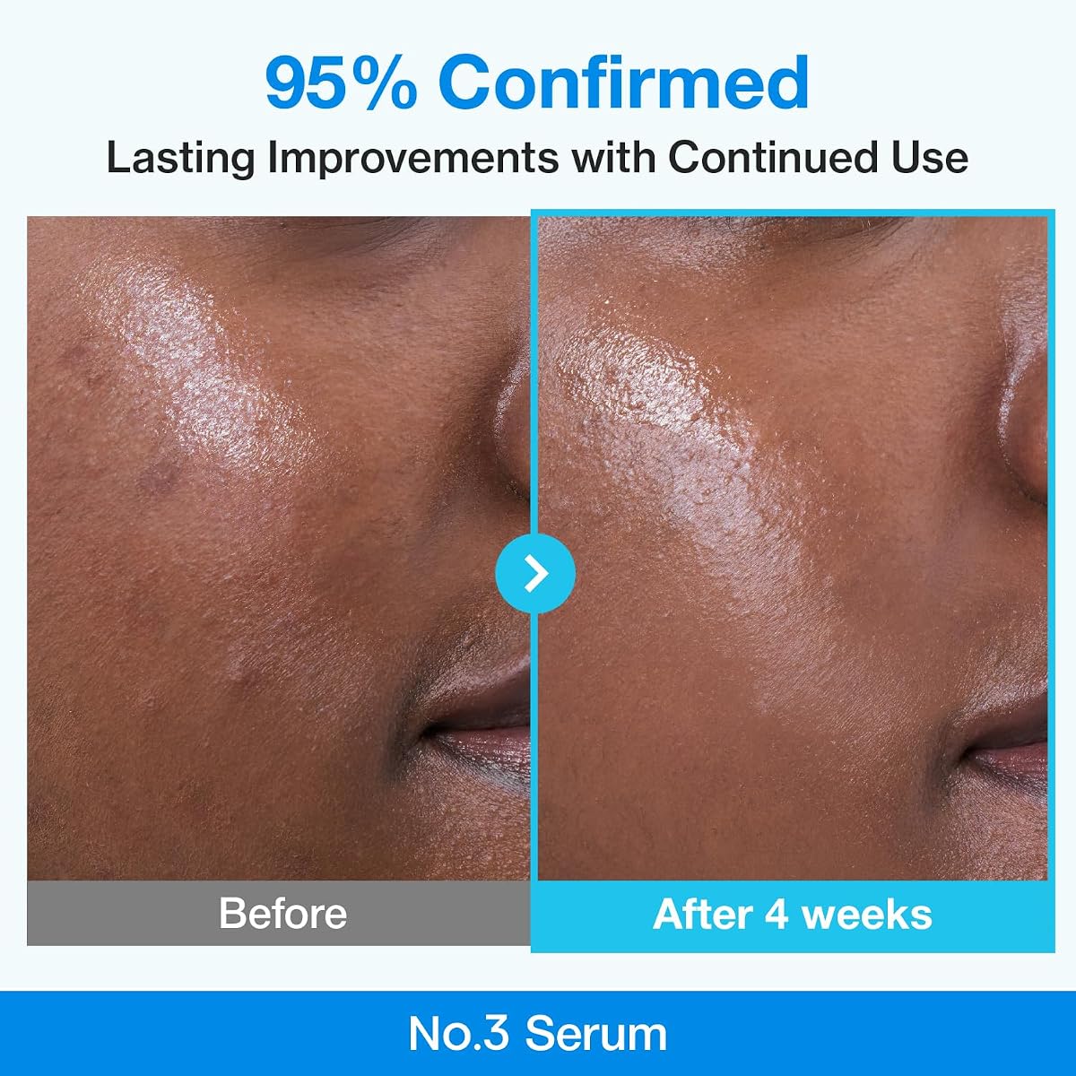 Numbuzin Blue Bio-Retinol Pore Refining Serum - Pore Tightening & Anti-Aging, 30ml - Image 4