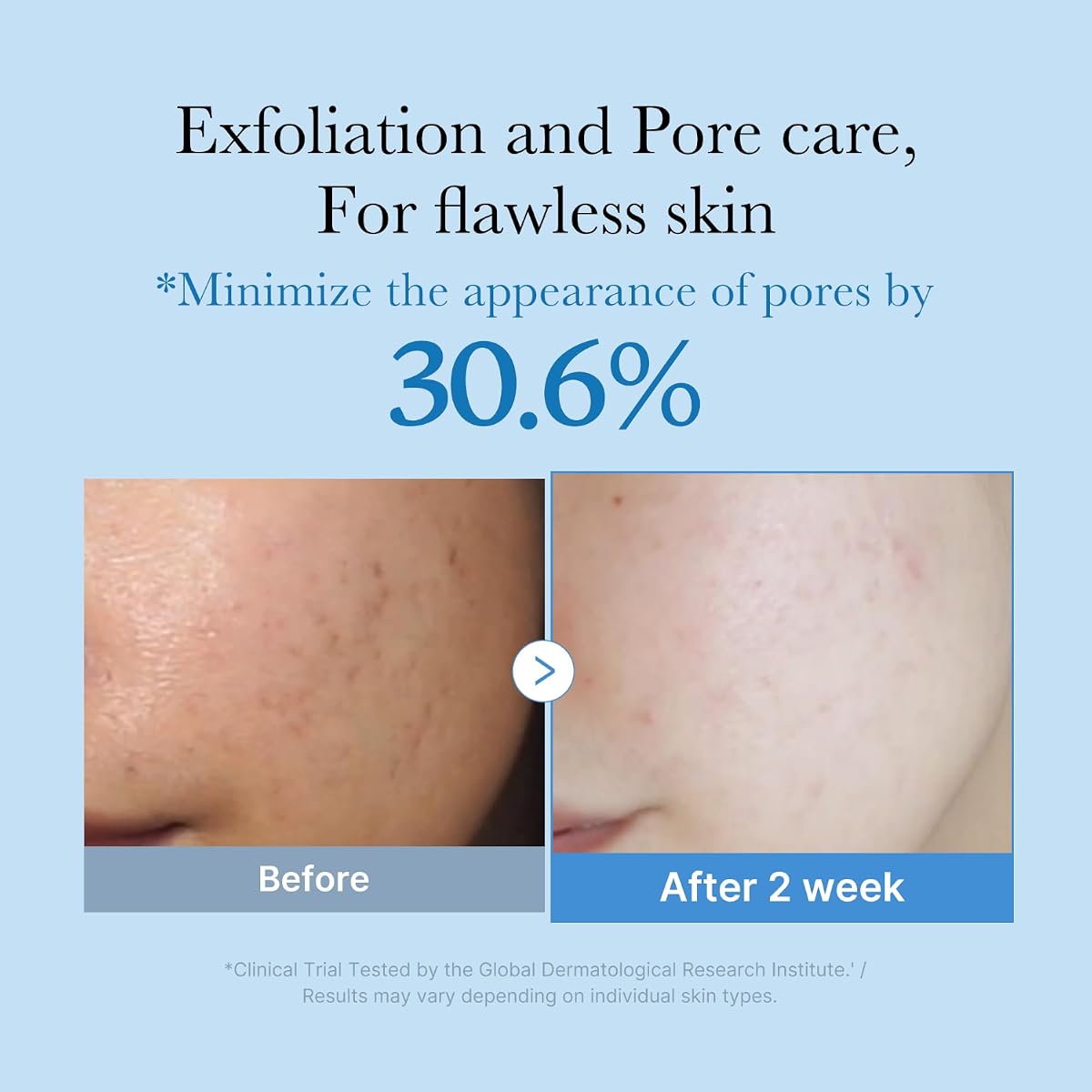 Medicube Zero Pore Toner - Exfoliating Blue Water Toner with AHA, BHA, PHA, Niacinamide - 250ml - Image 2