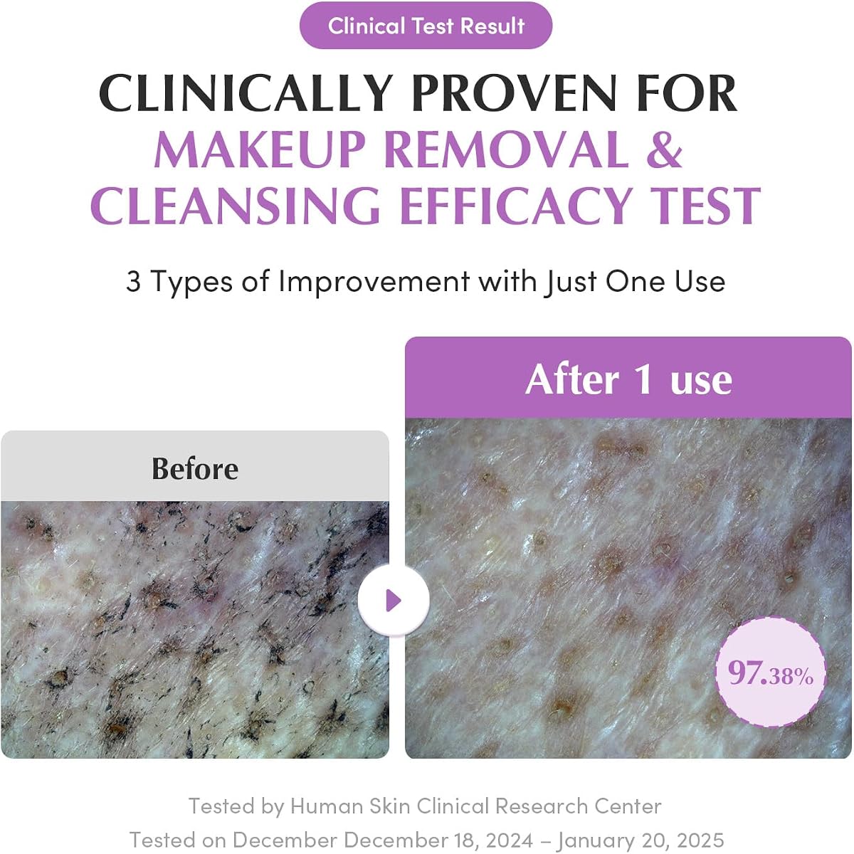 Eqqualberry Purple Rice Pore Smoothing Cleansing Oil - Korean Oil Cleanser, 200ml - Image 4