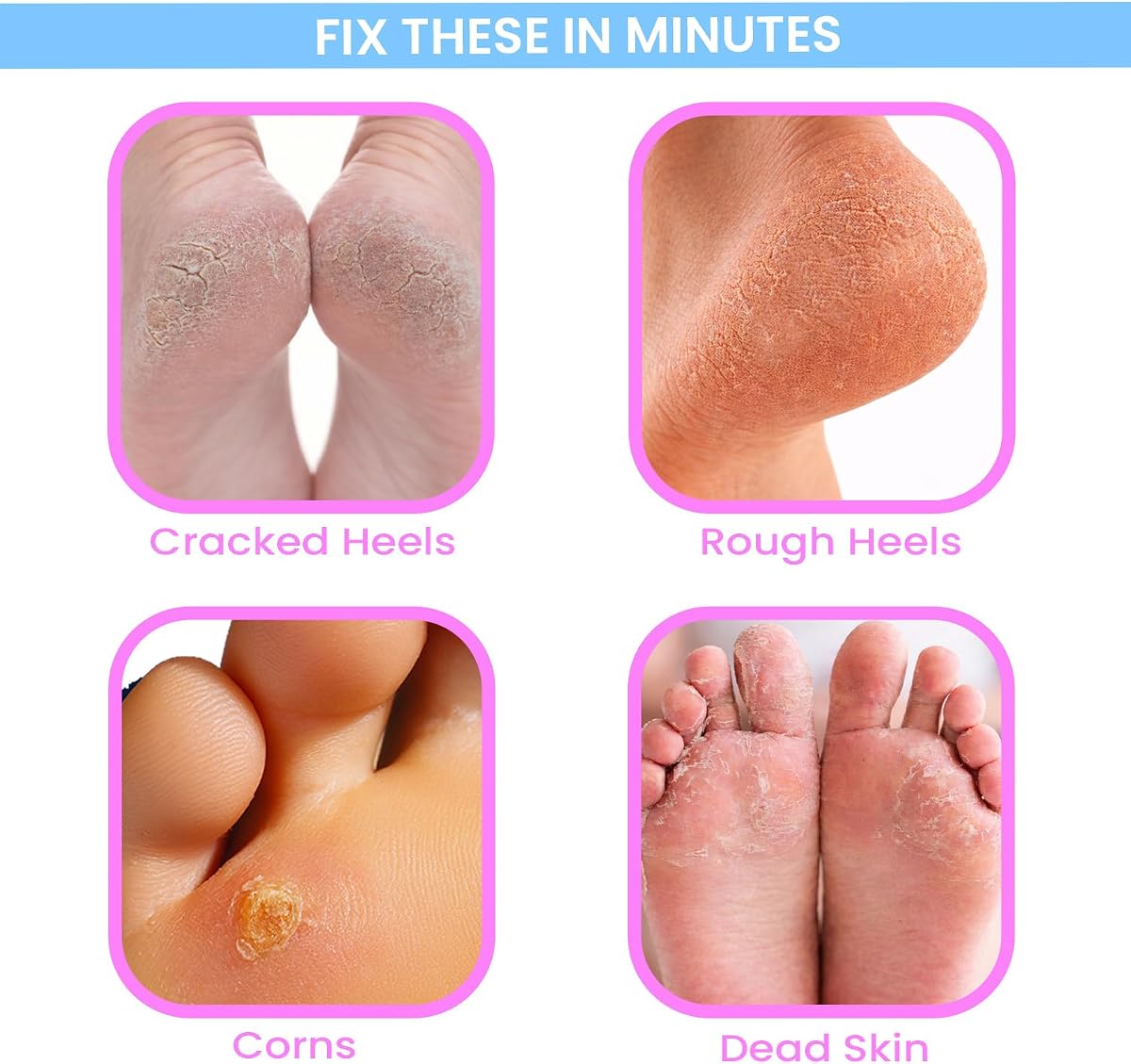 UrbanYog Callus Remover - 2-Speed, With 3 Roller Heads - 1 Unit - Image 3