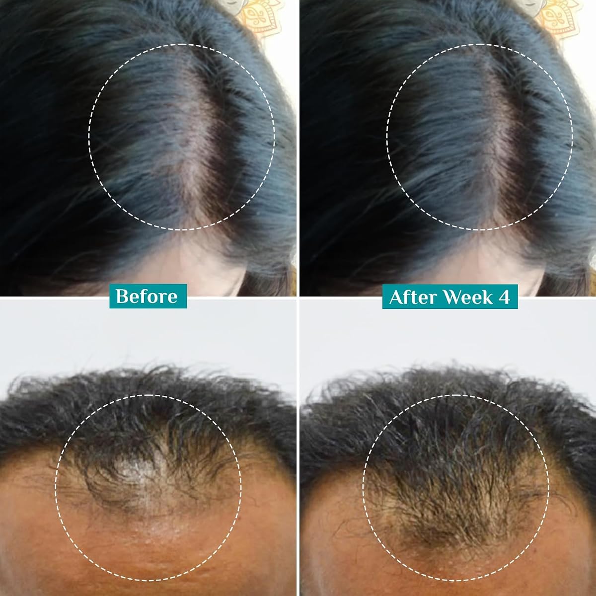 Pilgrim Hair Growth Serum with Redensyl, Anagain & Capilia - 30ml - Image 4