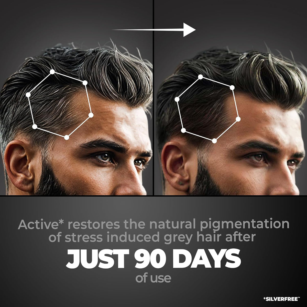 Beardo Anti Grey Hair Serum - 50ml Hair Treatment - Image 2