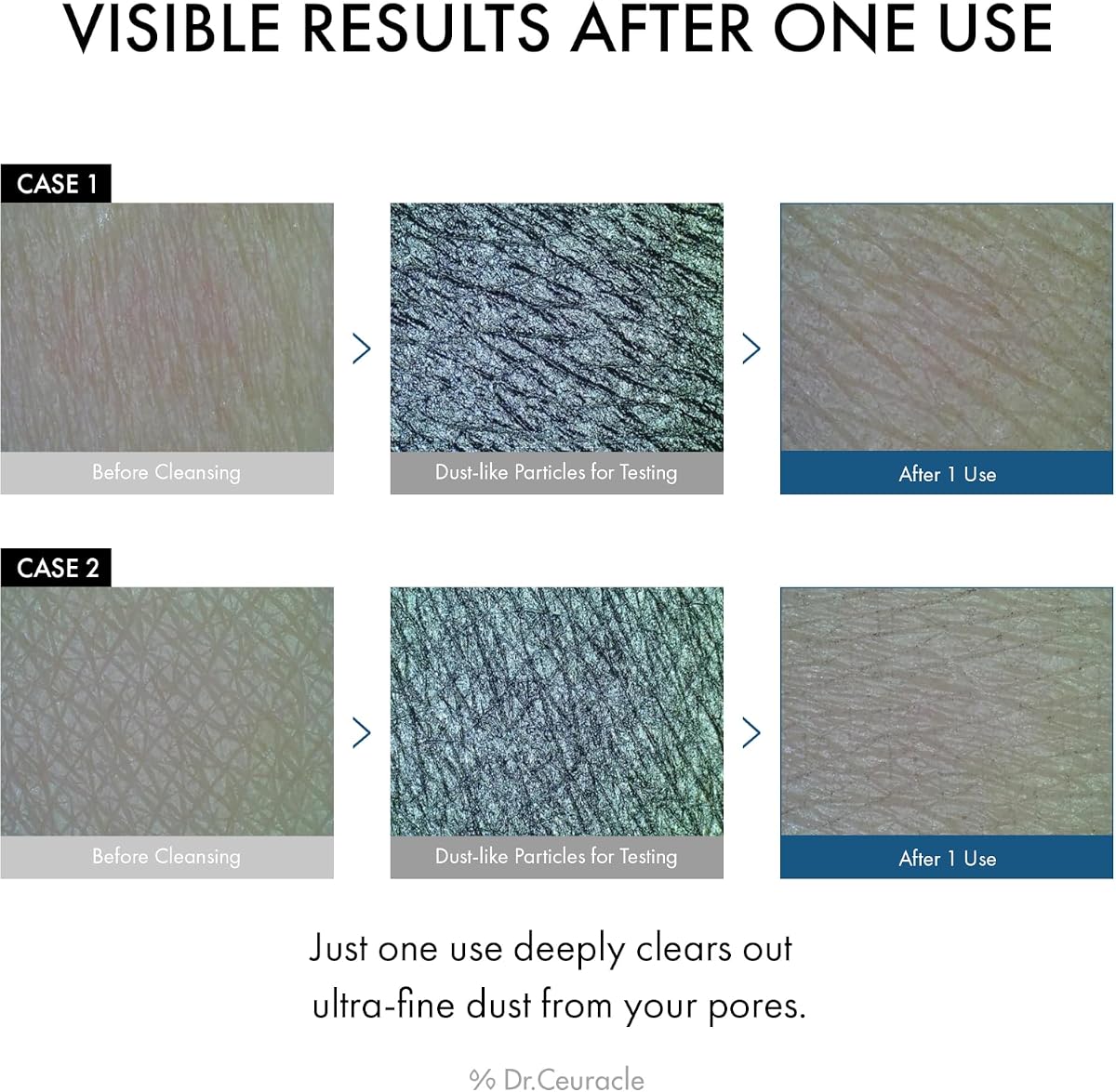 Dr.Ceuracle Pro Balance Night Enzyme Charcoal Wash - 50g - Image 2