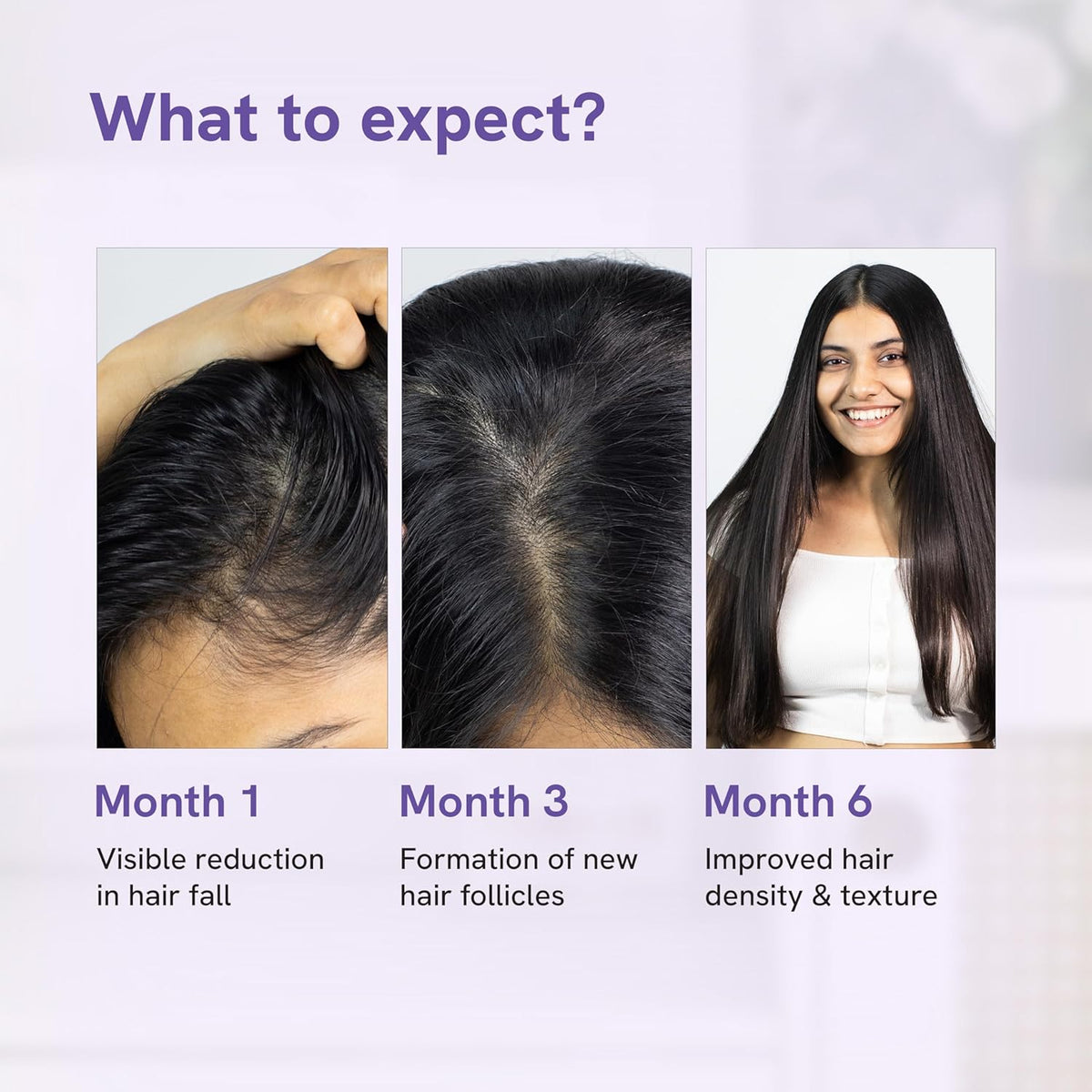 Be Bodywise Hair Growth Serum - 21% Actives, 3% Redensyl, 50ml - Image 5