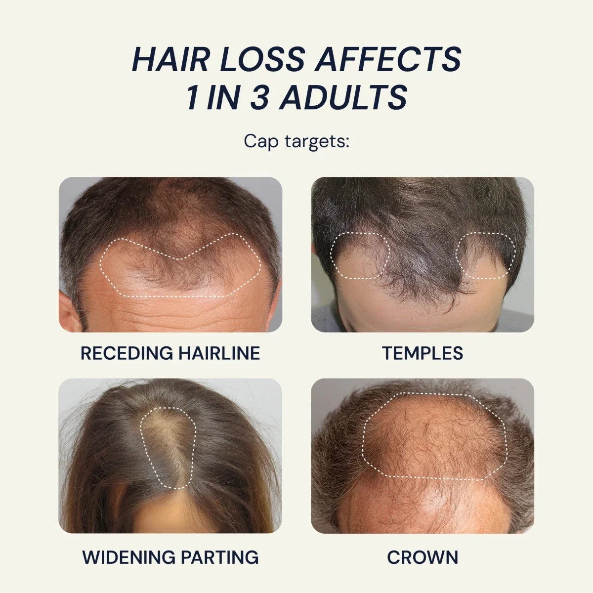 Blueprint 302 Laser Cap - FDA-Cleared, Hair Growth Treatment, 302 Diodes