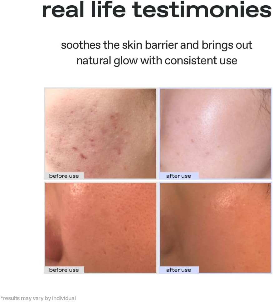 Glow Vegan Face Moisturiser - Aloe Vera Barrier Support, 50ml