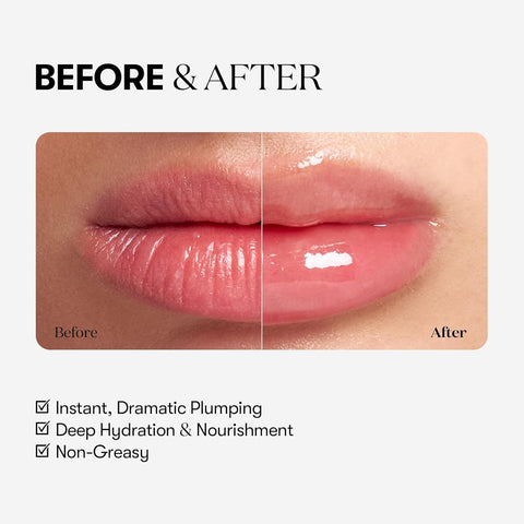 VT COSMETICS VT Reedle S Lip Plumper Expert, Clear Lip Gloss, 4.3 g, Fragrance Free, Moisturizing, Korean Cosmetic - Image 4