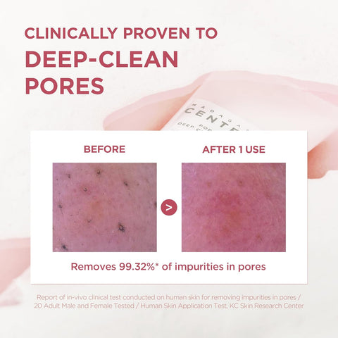 SKIN1004 Madagascar Centella Poremizing Deep Cleansing Foam 125ml - Image 3
