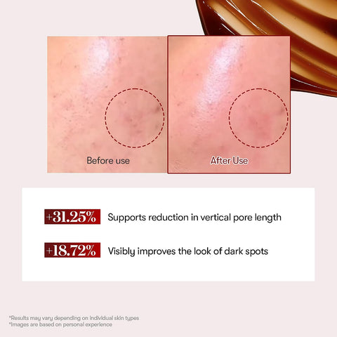 VT COSMETICS Red Booster Reedle Shot 100, Microneedling Serum with Dragon’s Blood, Exosome, Soothing Relief Serum for Irritated, and Sun-Stressed Skin, Scalp Care, Korean Skincare 1.69 fl oz (50ml) - Image 4