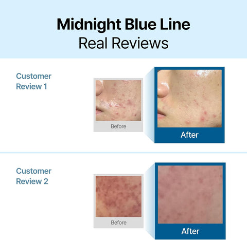 Klairs Midnight Blue Calming Cream 60ml - Image 4