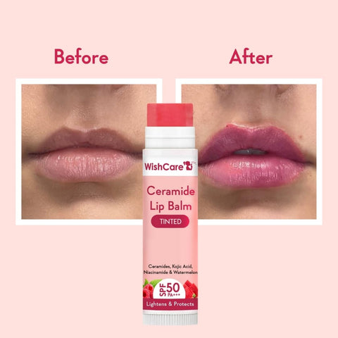Wishcare Tinted Ceramide Lip Balm with SPF50 PA+++ - Kojic Acid & Niacinamide - For Lip Lightening