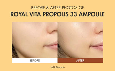 Dr. Ceuracle Royal Vita Propolis 33 Ampoule - Propolis & Vitamin Serum, 15ml - Image 3