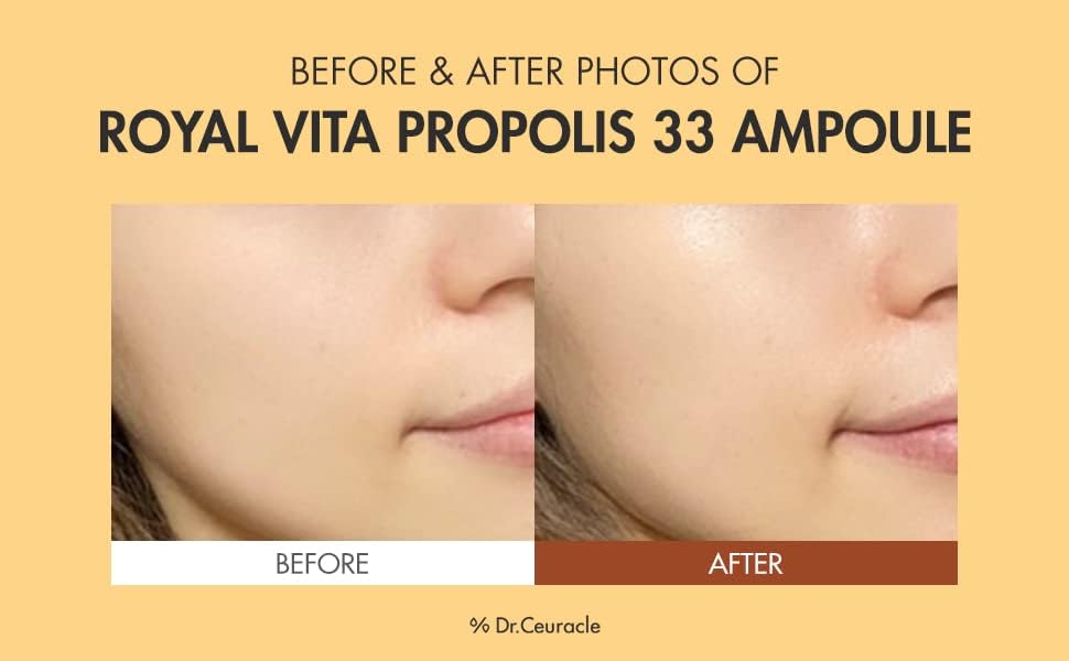 Dr. Ceuracle Royal Vita Propolis 33 Ampoule - Propolis & Vitamin Serum, 15ml - Image 3