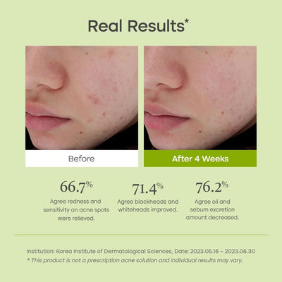 Purito Clear Code Superfruit Serum with Succinic Acid - 30ml - Image 3