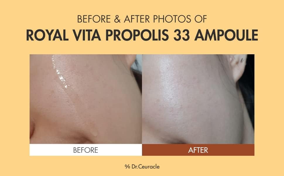 Dr.Ceuracle Royal Vita Propolis 33 Ampoule - Face Serum with Propolis Extract, 30ml - Image 5