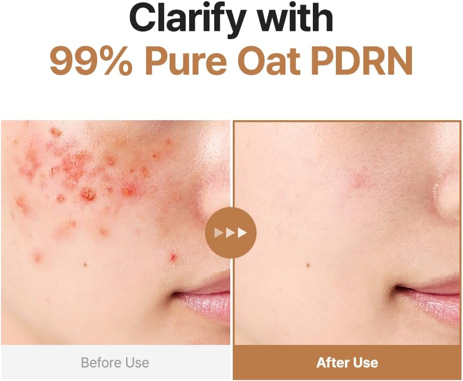 Purito Seoul Oat PDRN Gentle Refining Toner, 200ml - Face Serum & Treatment - Image 2