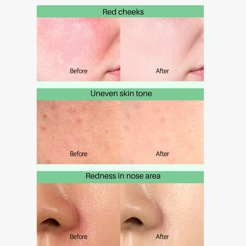d'Alba Clean Tea Tree Liposome Tone-Up Sun Cream Tone Correction & Brightening in One, Lightweight Silky Finish, SPF50+ UV Protection, with Tea Tree & White Truffle for Redness & Dull Skin 50ml - Image 8