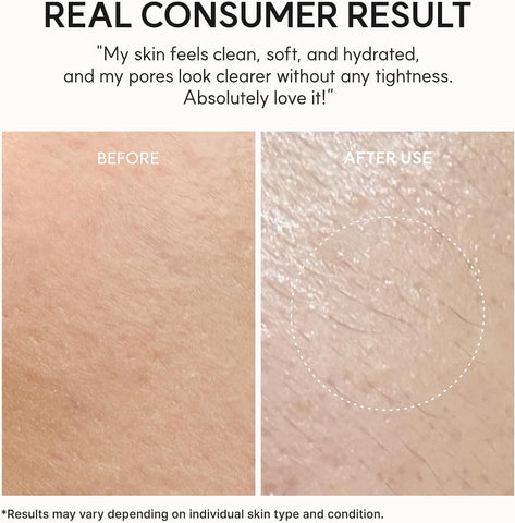 Arencia Rosehip Brightening Rice Mochi Face Cleanser & Daily Scrub - Moisturizing, Exfoliating & Deep-Cleansing - All Skin Types with Rice Powder & Rice Water (120g) - Image 8