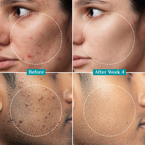 Pilgrim 2% Alpha Arbutin Brightening Serum- 30 ml