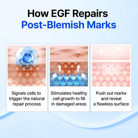 DearKlairs Korean EGF Serum – Blue Youth Activator Drop with EGF and FGF (10ppm each), barrier repair and post-imperfection marks, gentle on sensitive skin, soothing and repairing - Image 4