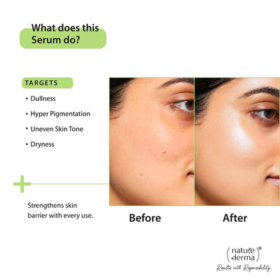 Nature Derma Face Serum with 2% Alpha Arbutin, 30ml - Image 3