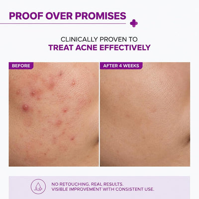 The Derma Co 2% Salicylic Acid Face Serum with Witch Hazel - 30ml - Image 3