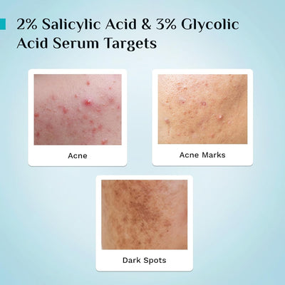 Pilgrim Anti-Acne Face Serum with 2% Salicylic Acid - 30ml - Image 4