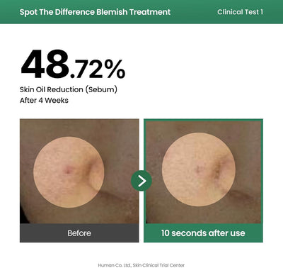 AXIS-Y Spot the Difference Blemish Treatment Serum 15ml - 4-Terpineol & Niacinamide - Image 5