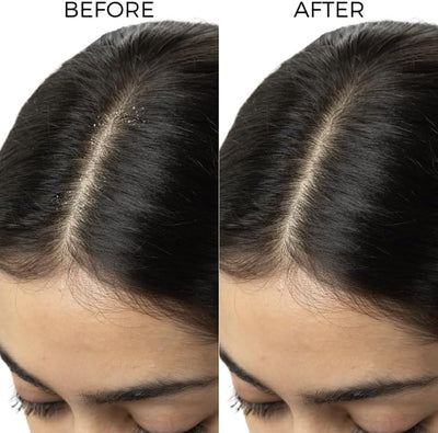 Brillaire Lactylate Scalp Serum - Hair Treatment Oil, 30ml - Image 5