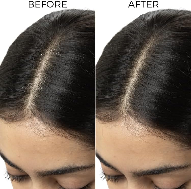 Brillaire Lactylate Scalp Serum - Hair Treatment Oil, 30ml - Image 5