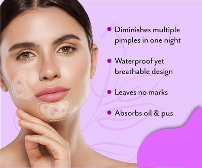 UrbanYog Acne Curvy Pimple Patch - 100% Hydrocolloid for Large Spots - Image 5