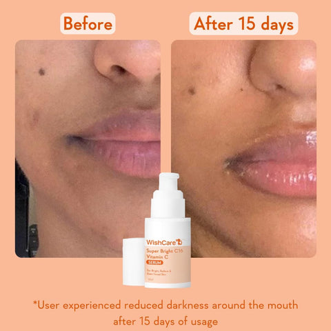 WishCare Super Brightning Vitamin C Serum