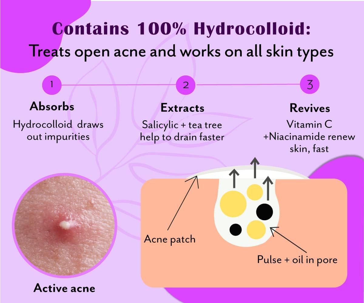 UrbanYog Acne Curvy Pimple Patch - 100% Hydrocolloid for Large Spots - Image 3