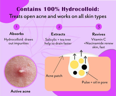 UrbanYog Acne Curvy Pimple Patch - 100% Hydrocolloid for Large Spots - Image 3