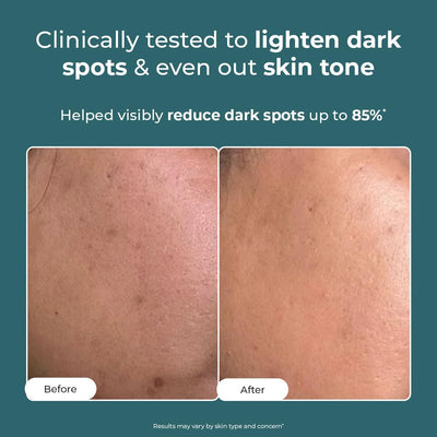 Conscious Chemist Face Moisturiser with Kojic Acid - 50g - Image 2