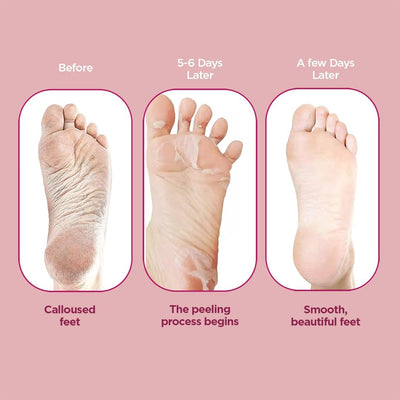 Pee Safe Furr Exfloating Foot Peel Mask - Foot Exfoliator Mask - Image 5