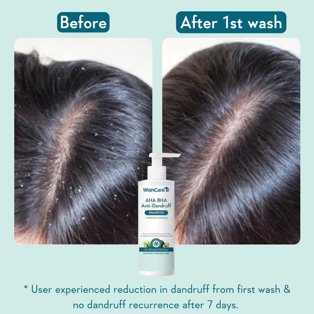 Wishcare AHA BHA Anti-Dandruff Shampoo | Hydrating Formula - 250ml