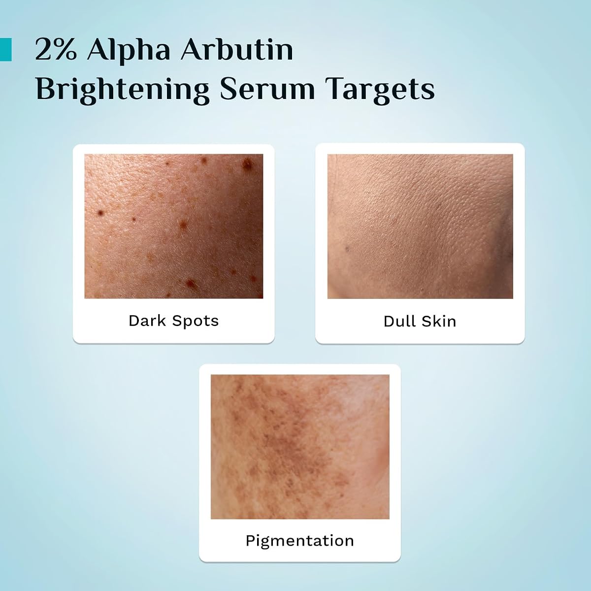 Pilgrim Korean Brightening Face Serum with Alpha Arbutin & Vitamin C - 30ml - Image 5